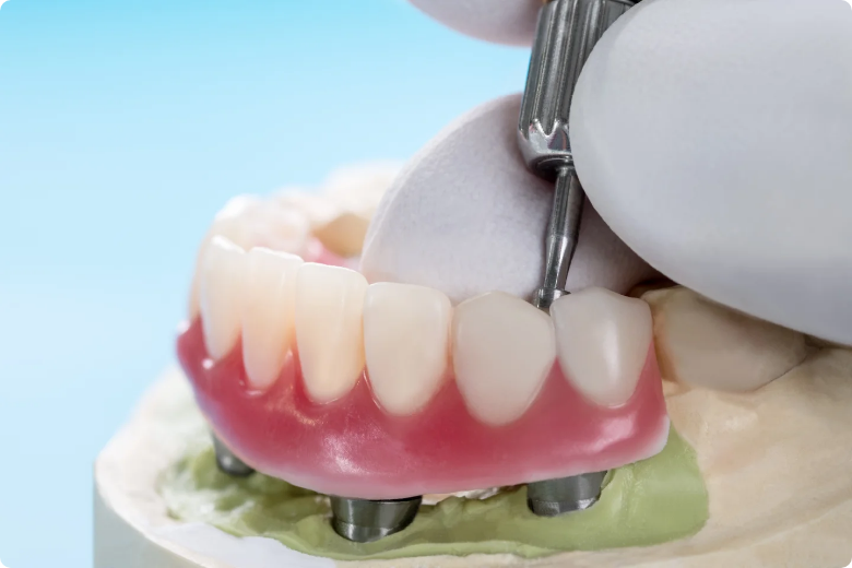 Crowns and bridges at Star Dental Institute